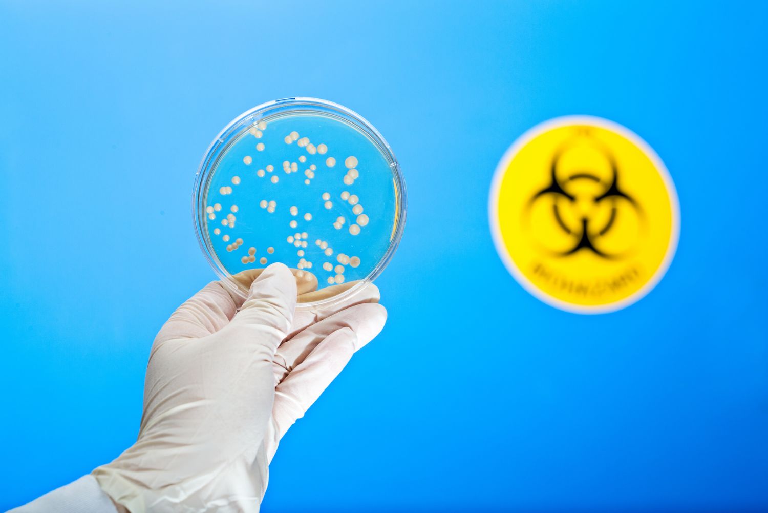 Valutazione Rischio Biologico: Prevenzione, gestione e importanza